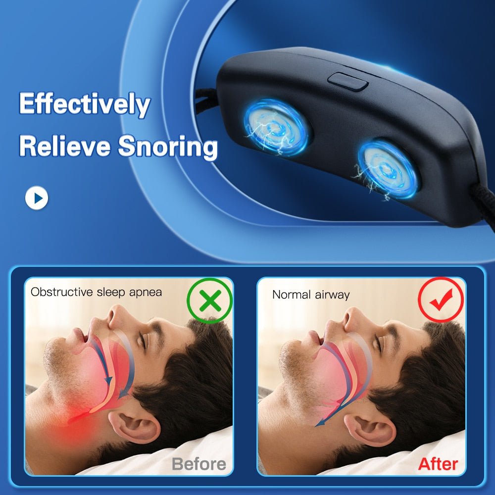 50% Rabatt | SleepPro™️ Intelligentes Anti-Schnarch-Gerät